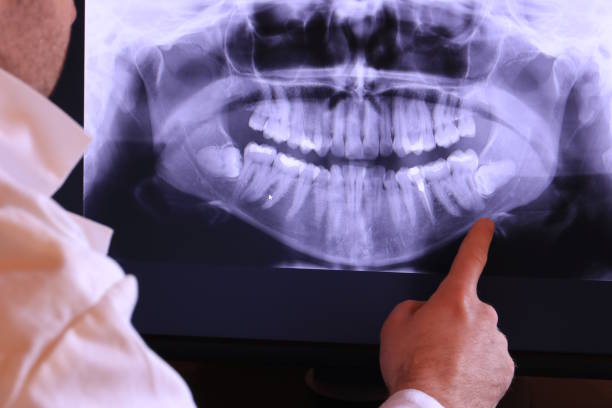 Best After-Hours Emergency Dentist in Aurora, SD